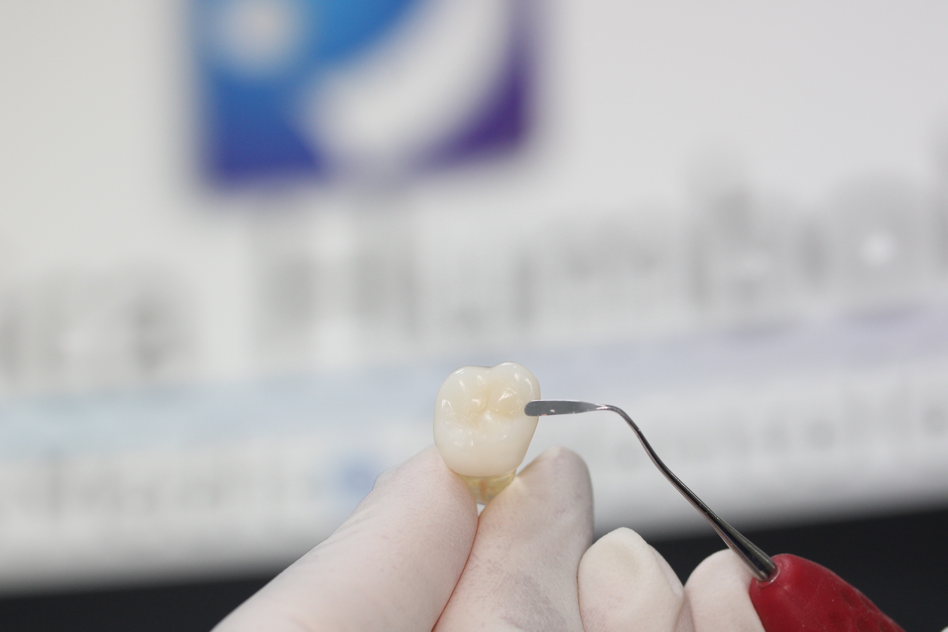 Prótesis Dental