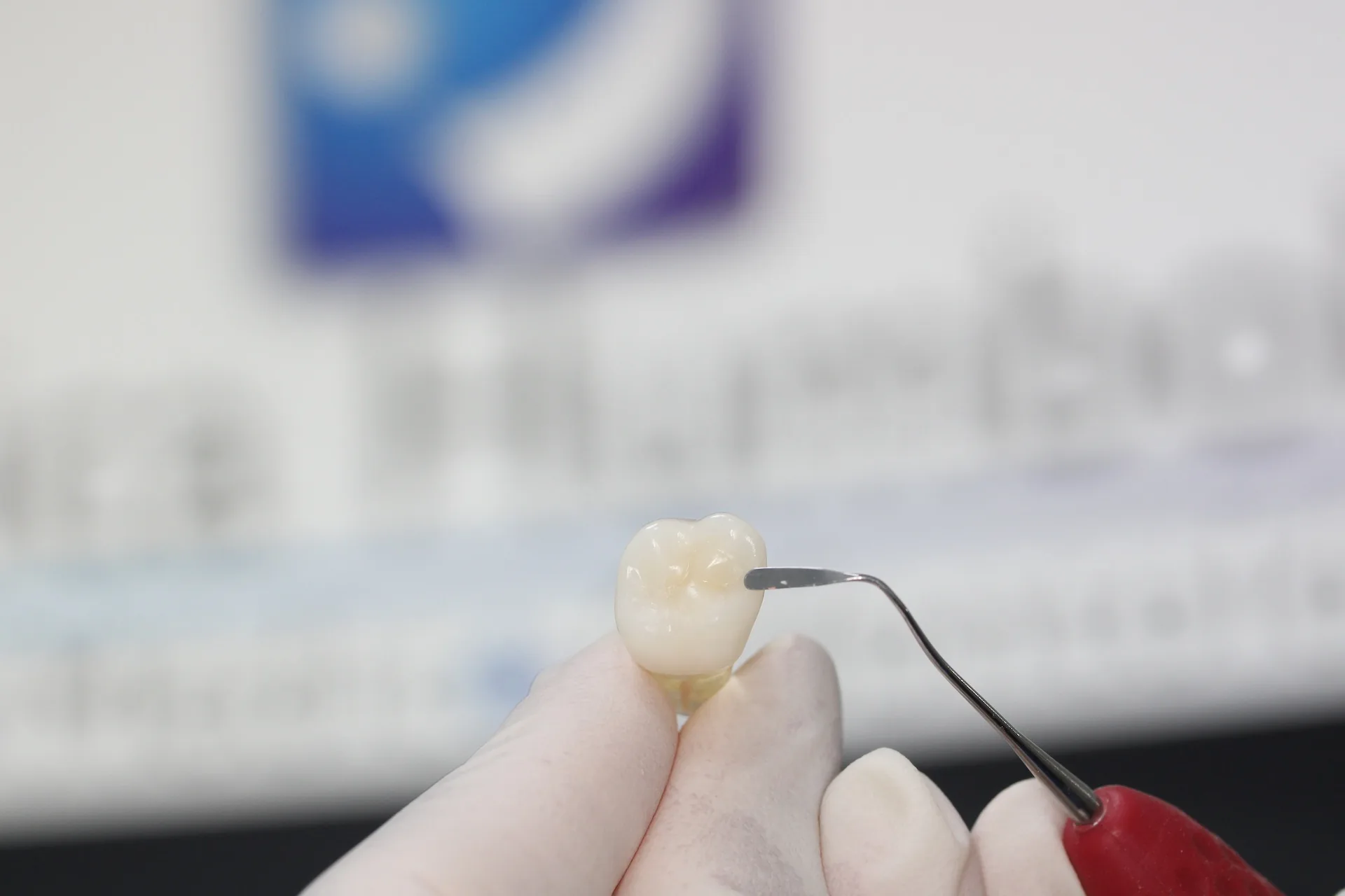 Prótesis Dental